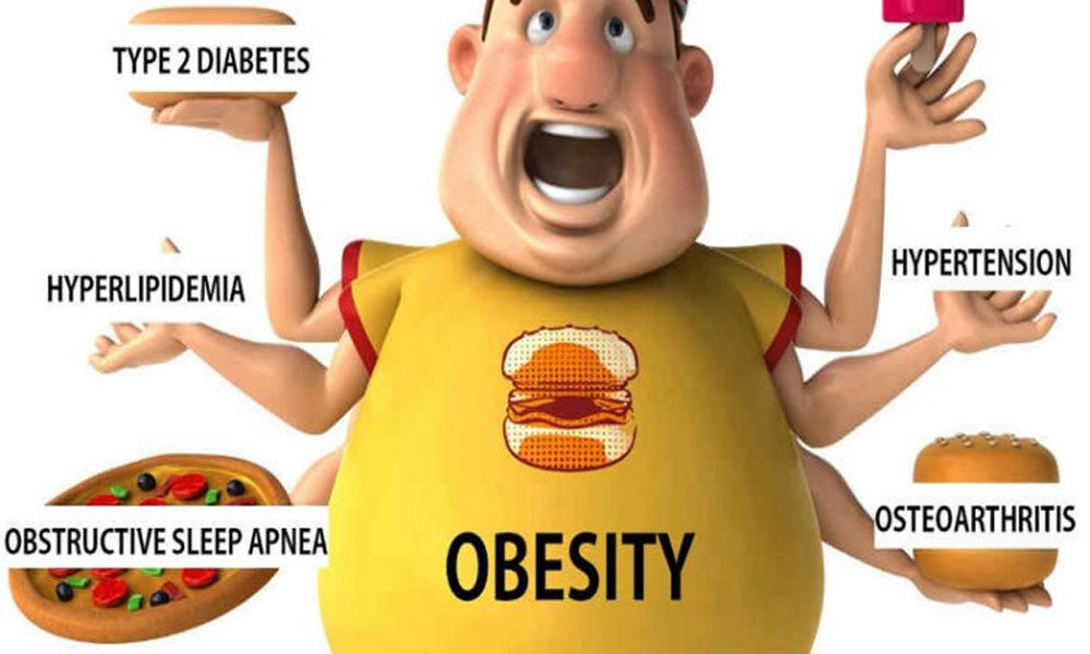 A person with obesity can have type 2 diabetes, Hyperlipidemia, obstructive sleep apnea, hypertension, osteoarthritis, etc.