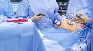 Minimal Invasive surgery in pcmc