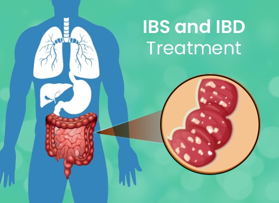 IBS and IBD Treatment