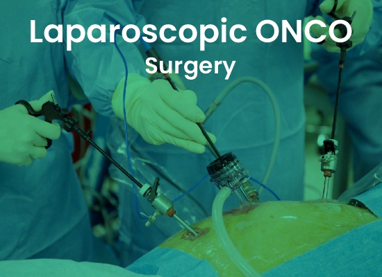 Laparoscopic Surgery