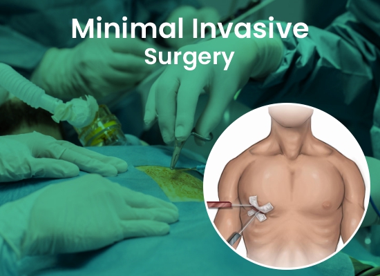 Minimal Invasiv Surgery